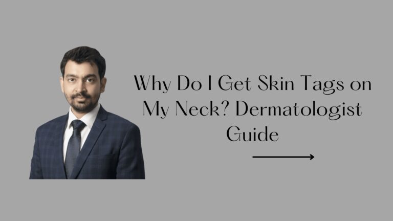 Why Do I Get Skin Tags on My Neck? Dermatologist Guide