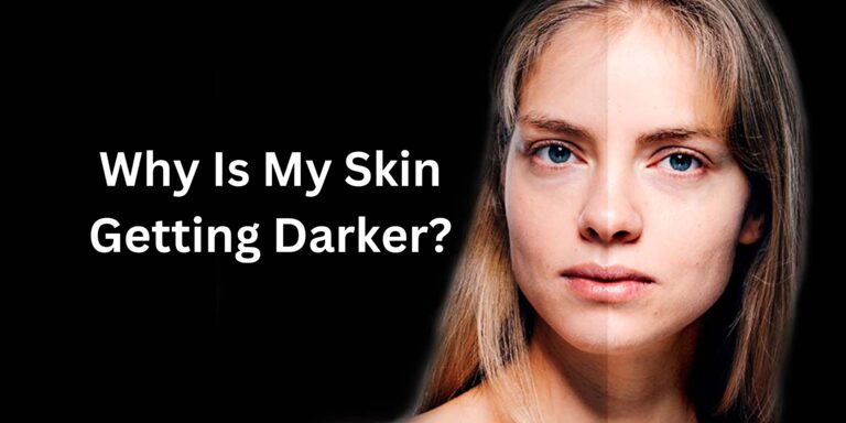 Why Is My Skin Getting Darker?