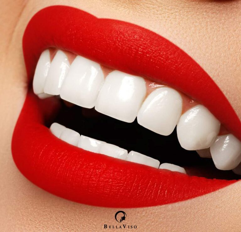 Oral Radiance: Choosing the Best Teeth Cleaning Medical Center in Dubai
